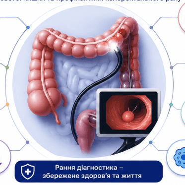 Як правильно підготуватися до колоноскопії?